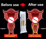 tightening wand for the vagina