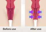 Before and after Effect of vaginal gel
