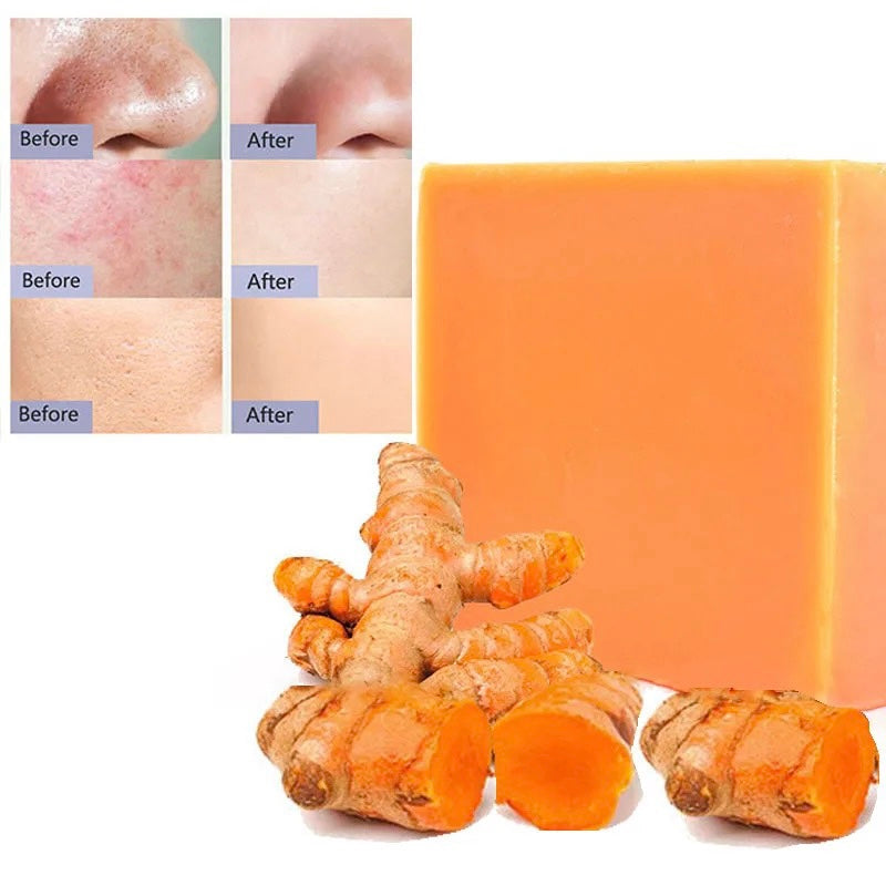 Turmeric Skin Brightening Soap before and after picture